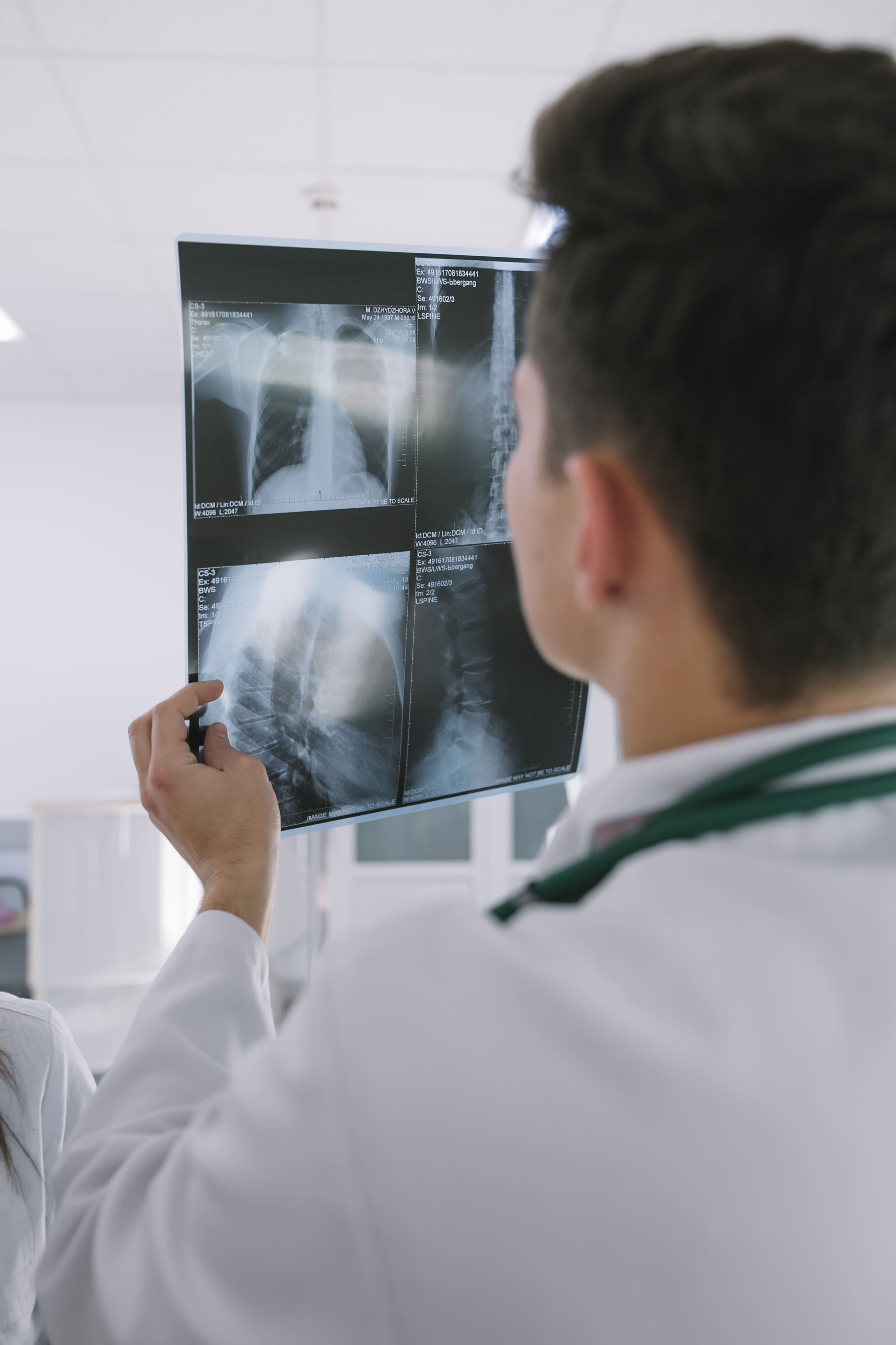 Digital X-Ray